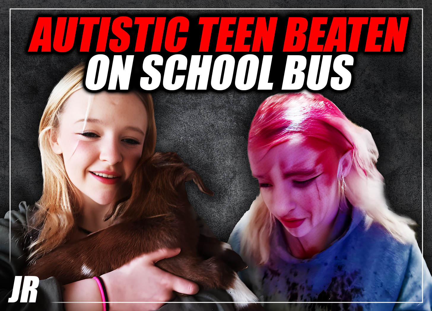 Exclusive: Teenage girl with autism bloodied in violent school bus ambush